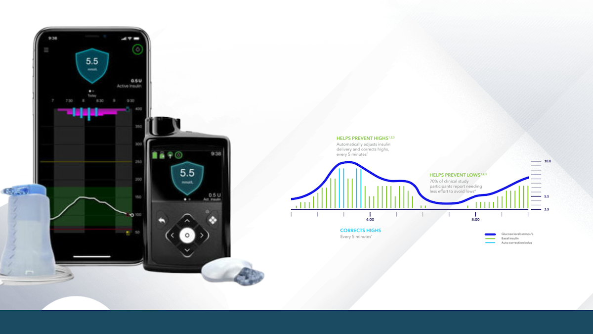 Uzlabotā SmartGuard™ tehnoloģija palīdz paildzināt Laiku Diapazonā ar mazāku piepūli
